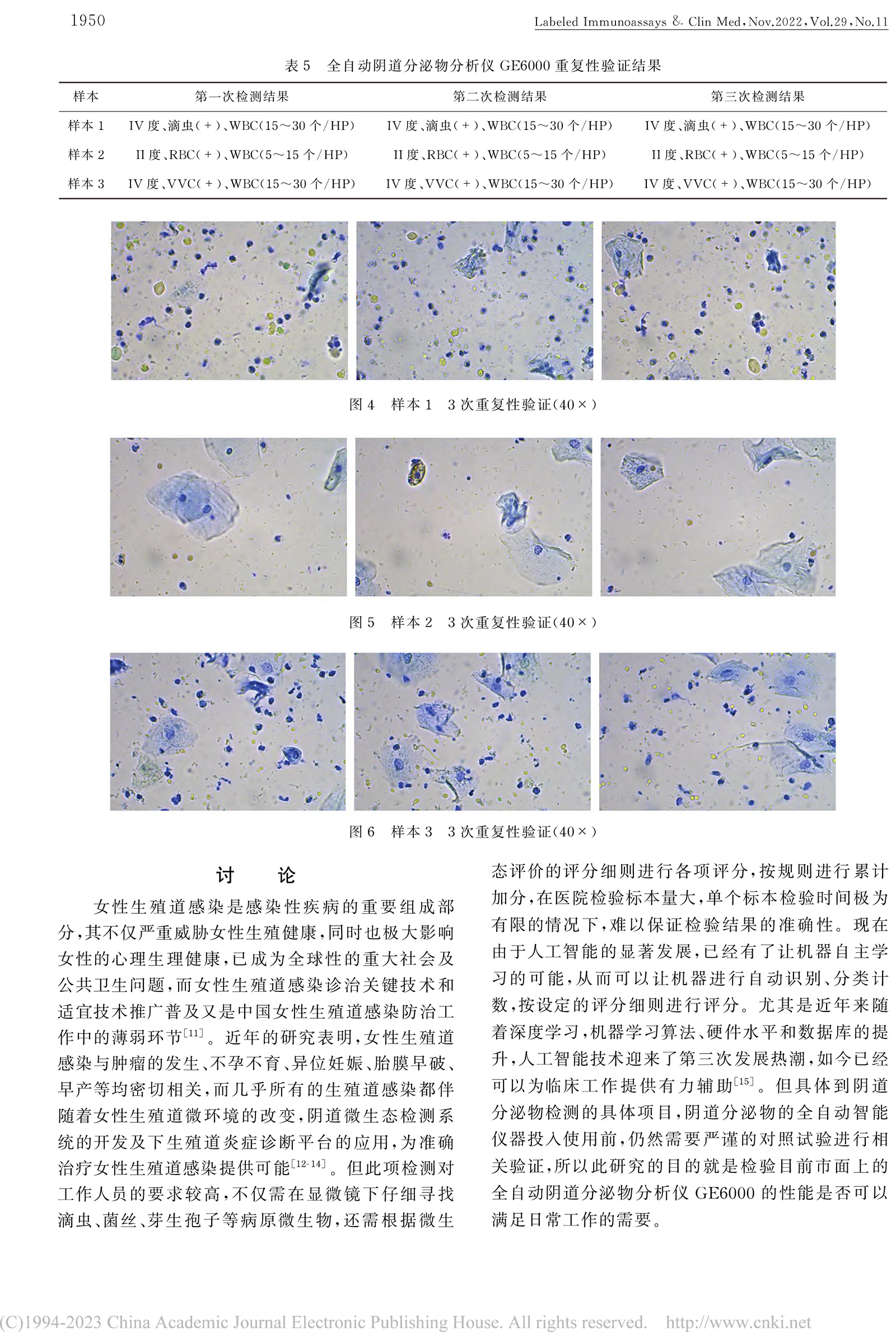 1_GE6000型全自动阴道分泌物分析仪临床应用评价-5.jpg